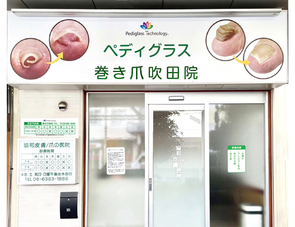 直営『ペディグラス巻き爪　吹田院』開院